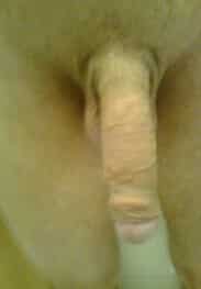 Diskretan
