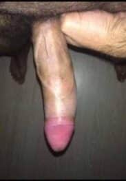 OBDAREN