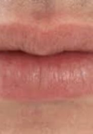 Oral gratis Beograd
